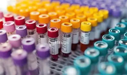 Test Tubes & RIA Vials